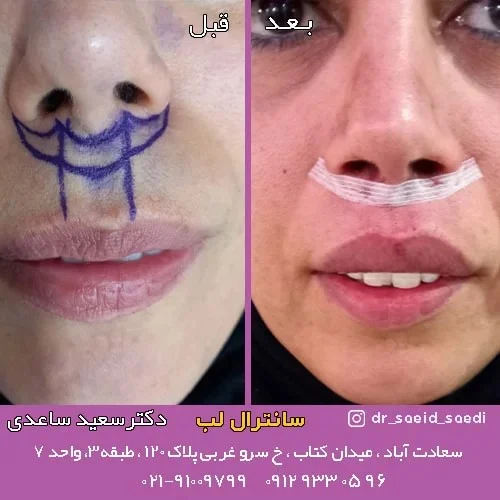 سانترال لب چیست و بررسی نکاتی راجبه آن