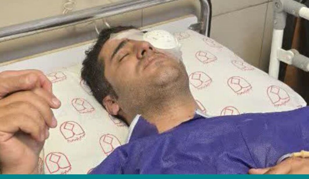 اصفهان محیطبان اصفهانی بر اثر شلیک مستقیم شکارچی راهی بیمارستان شد - خبرگزاری مهر | اخبار ایران و جهان