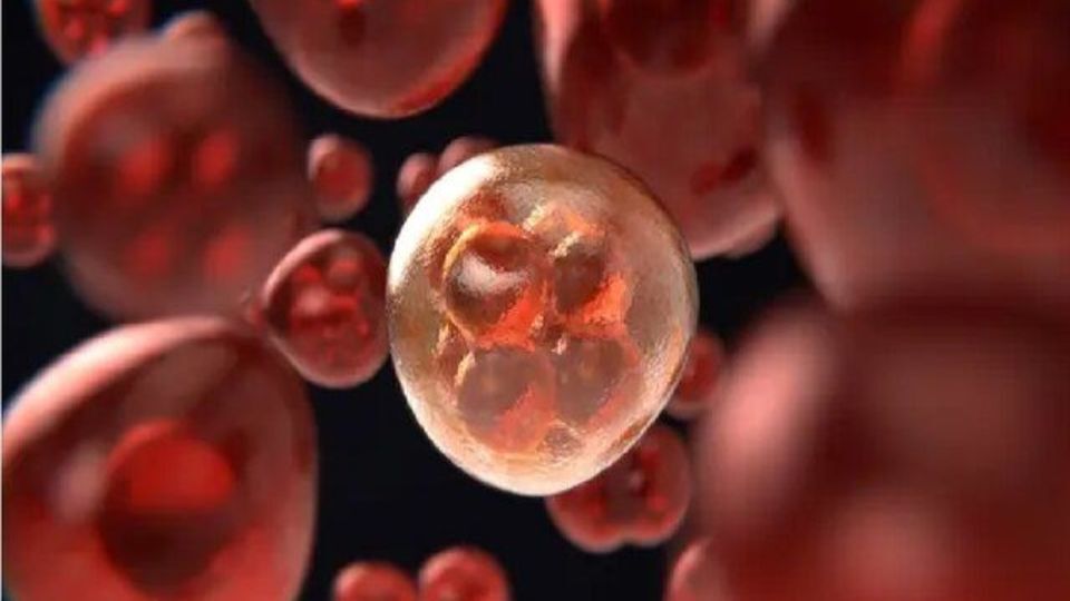 ارتباط دیابت نوع ۲ با سرطان‌های کبد و لوزالمعده