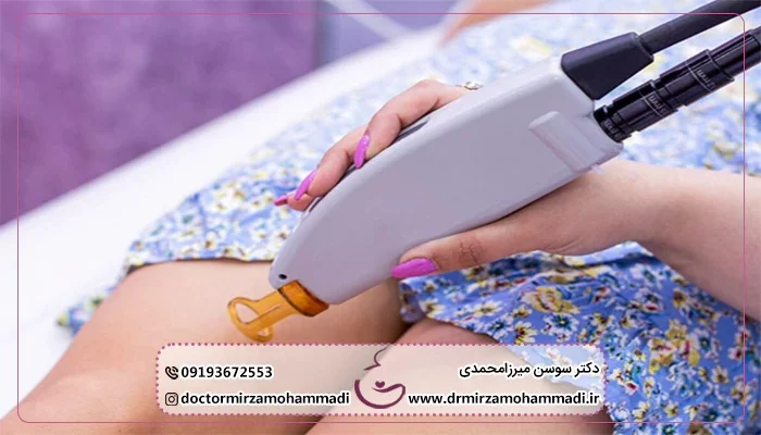 جوانسازی واژن بدون جراحی و درد با لیزر ژولیت واژینال