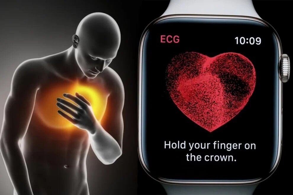 مرد آمریکایی با کمک اپل واچ از مرگ گریخت / سکته هنگام ورزش